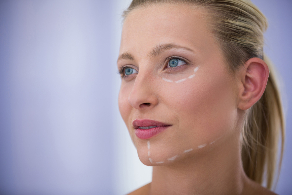PDO thread lift facial assessment at LDS Melbourne